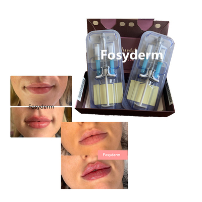 Juvederm volbella Hyaluronic Acid Lips Filler Cross Linked 24 مجم