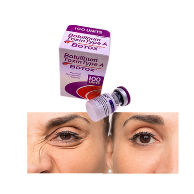 إزالة خطوط الوجه توكسين البوتولينوم 100 وحدة حساسية البوتوكسو