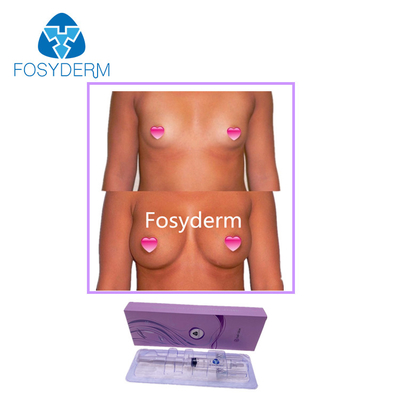Fosyderm 10ML حمض الهيالورونيك الحشو الجلدي الأرداف وحقن تكبير الثدي