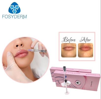 Fosyderm 1ml مرتبط Cross Hyaluronic Acid Injectable Filler CE ISO