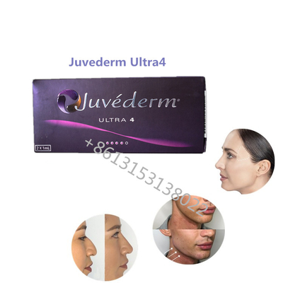 ملء الشفاه Juvederm Ultra4 Allergan Dermal Filler Juvederm HA Fillers للشفاه