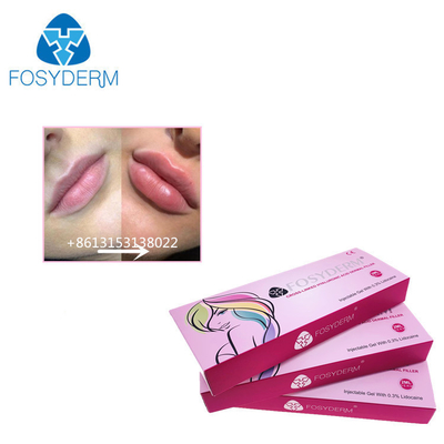 Fosyderm 1ml حمض الهيالورونيك حقن ملء الجلد لزيادة حجم الشفاه