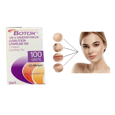 Allergan 100 وحدة البوتولينوم توكسين حقن البوتوكس إزالة التجاعيد العملية