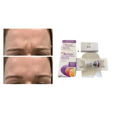 White Allergan Botulinum Toxin مكافحة الشيخوخة حقن البوتوكس