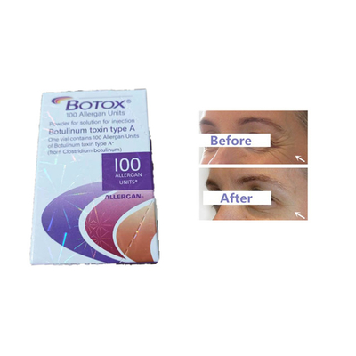 Allergan Botox Injection Botulinum Toxin 100 وحدة تجاعيد الجبين