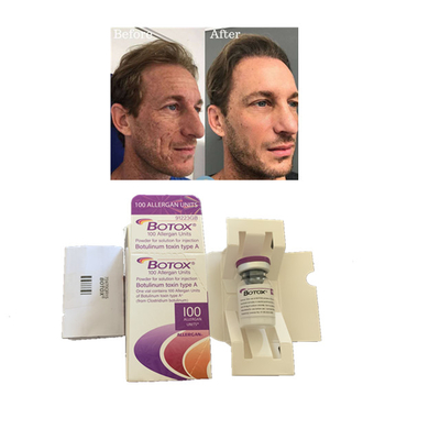Allergan  100 وحدة أنواع حقن توكسين البوتولينوم المضادة للتجاعيد