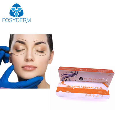 Fosyderm Hyaluronic Acid Dermal Filler طويل الأمد للحقن التجميلي