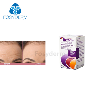 100 وحدة من حقن Allergan  Botulinum Toxin لمكافحة التجاعيد