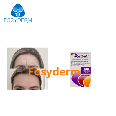 100 وحدة من حقن Allergan  Botulinum Toxin لمكافحة التجاعيد