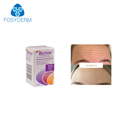 Allergan  100 وحدة Botulinum Toxin مضاد للتجاعيد من النوع A حقن
