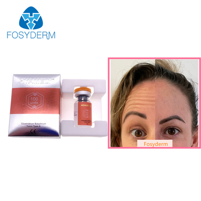 100 وحدة من نوع A Botulinum Toxin Allergan المضاد لتجاعيد الوجه حقن البوتوكس البوتولاكس