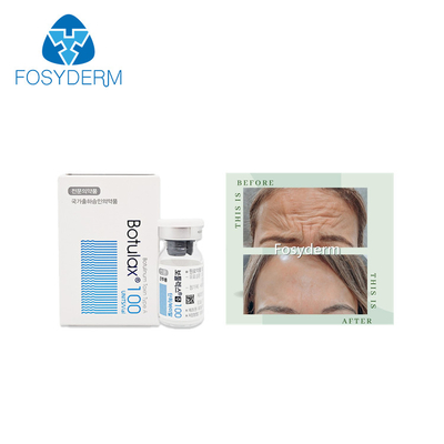 100 وحدة من نوع A Botulinum Toxin Allergan المضاد لتجاعيد الوجه حقن البوتوكس البوتولاكس