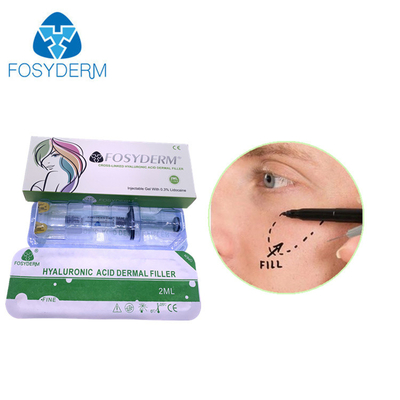 Fosyderm عميق 2ml حشو الجلد لتجديد الوجه HA حشو