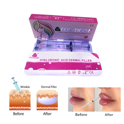 Fosyderm 2ml هيل حمض الهيالورونيك حقن ملء الجلد لعناية بشرة الوجه والأنف