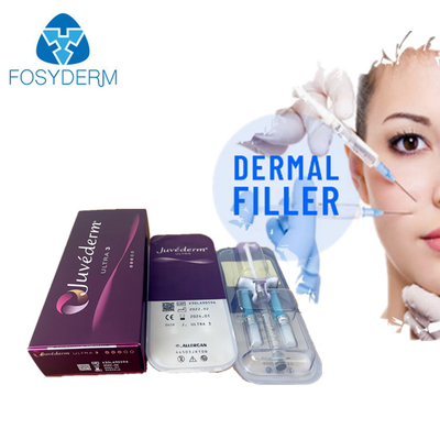 Juvederm Ultra3 حقن حشوة جلدية حقن حمض الهيالورونيك للوجه