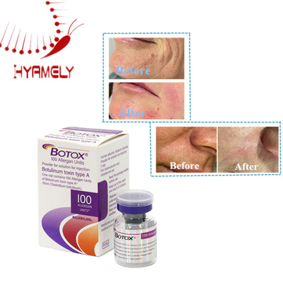 توكسين البوتولينوم للعناية بالبشرة الفعال 100 وحدة مسحوق قابل للحقن من Allergan