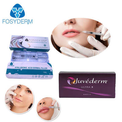 Juv HA حشو جلدي 24mg/ml لشفاه الوجه الخدين 1ml 2ml