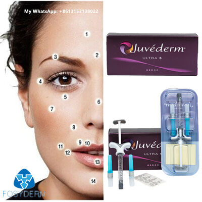 JUVÉDERM حشيش للحقن Juvederm حشيش جلدي 2 مل حشيش شفاه