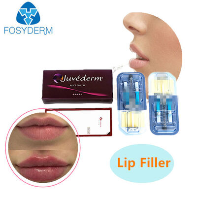 Juvederm الحمض الهيالوروني الحامض الجلدي لرفع الشفاه والوجوه 24mg