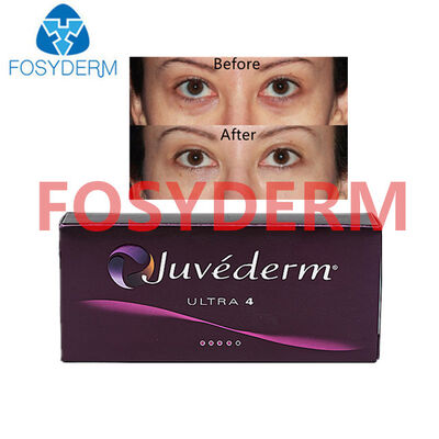 Juvederm الحمض الهيالوروني الحامض الجلدي لرفع الشفاه والوجوه 24mg