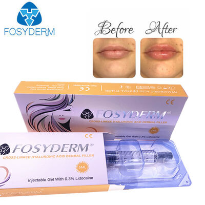 Hyaluronic Acid Dermal Filler Face Lifting 1ml 2ml