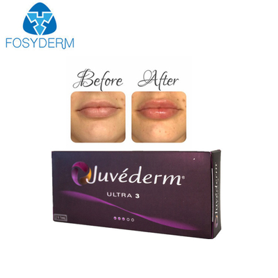 Juvederm Ultra 3 1 Ml * 2 Hyaluronic Acid Dermal Filler Lip Injections حقن الشفاه