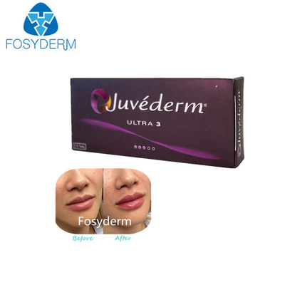 Juvederm Ultra 3 1 Ml * 2 Hyaluronic Acid Dermal Filler Lip Injections حقن الشفاه