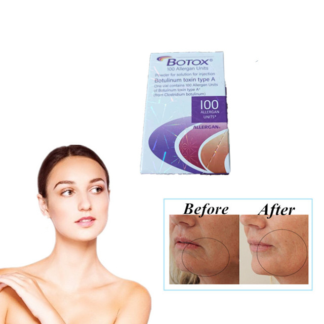 Allergan  100 وحدة أنواع حقن توكسين البوتولينوم المضادة للتجاعيد