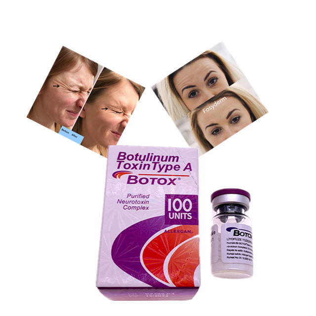 Allergan Botulinum Toxin Type A  100 وحدة حشو جلدي حمض الهيالورونيك