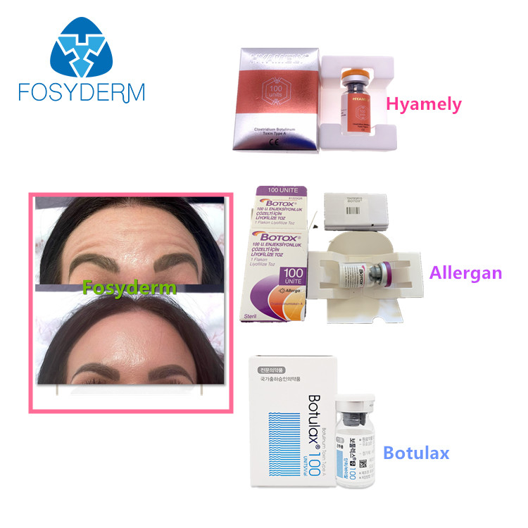 100 وحدة من نوع A Botulinum Toxin Allergan المضاد لتجاعيد الوجه حقن البوتوكس البوتولاكس