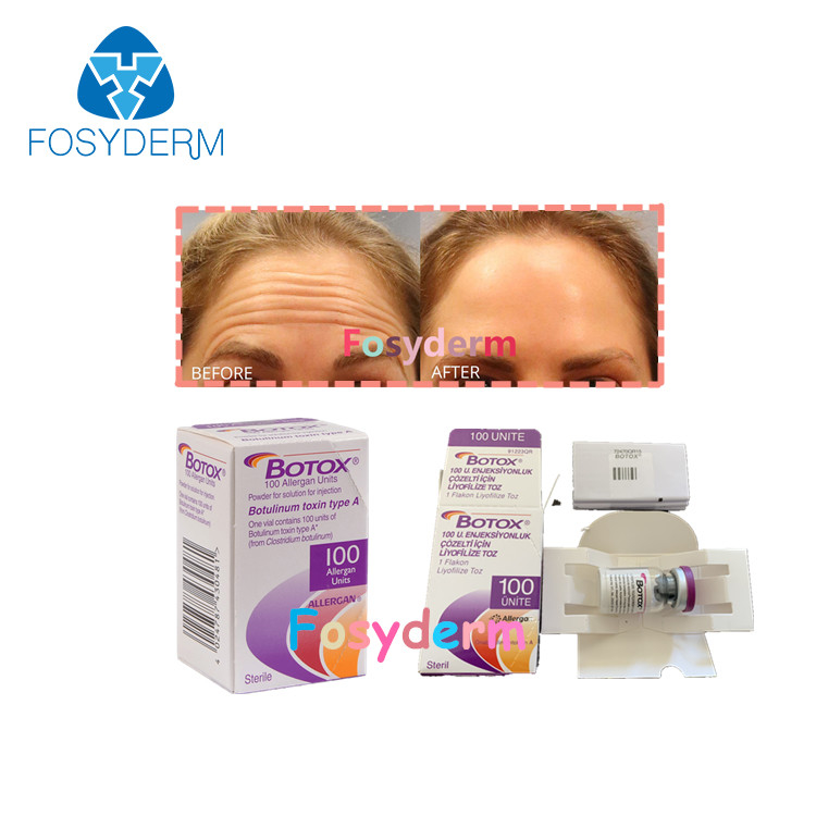 100 وحدة من البوتولينوم المضاد للتجاعيد والسموم Allergan Injection TypeA