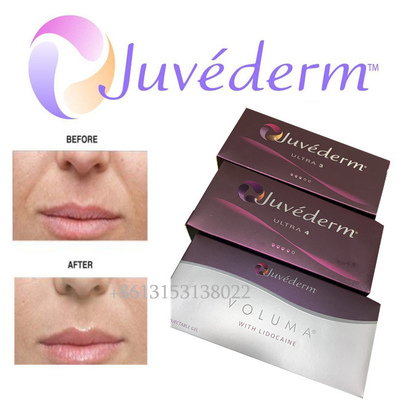 حشو الوجه بحمض الهيالورونيك Juvederm طويل الأمد Ultra3 Ultra4 Voluma Injection