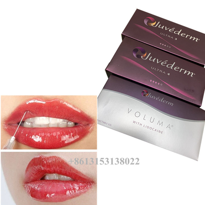 جيل ملء الجلد من حمض الهيالورونيك Juvederm Voluma 24mg/Ml ملء الجلد