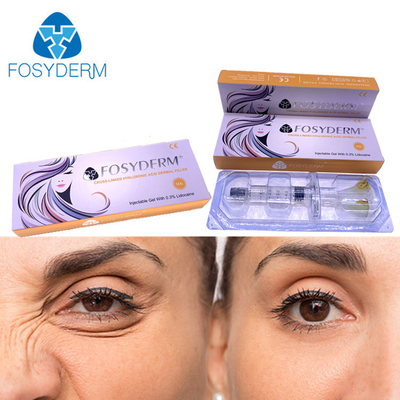 5 مللي حمض الهيالورونيك Fosyderm حقن حشو جلدي للشفاه والأنف
