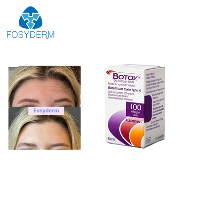حقن Allergan Botulinum Toxin يزيل التجاعيد 100 وحدة من البوتوكس