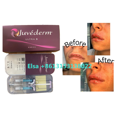 مستحضرات التجميل جوفيديرم فيلر للوجه