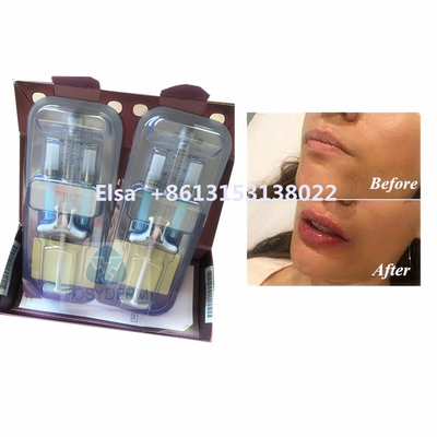 منتج التجميل Juvederm Voluma حمض الهيالورونيك حشو الوجه HA الحقن