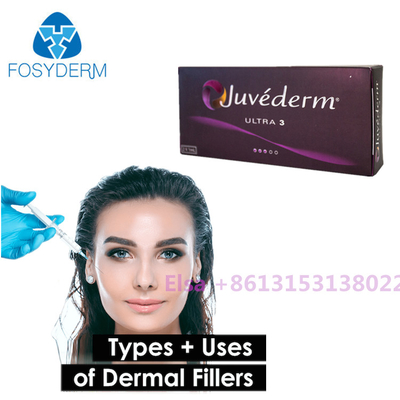 Voluma / Ultra Juvederm Dermal Fillers Juvederm Syringe with Lido