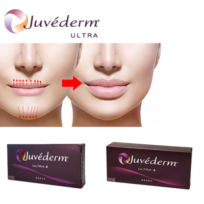 Juvederm Ultra3 الحمض الهيالوروني لملء الشفاه الجيل الجلوي للمحقن المملوء مسبقًا