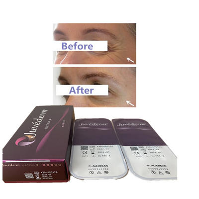 جوفيديرم 2 مل Ultra3 Ultra4 Voluma Hyaluronic Acid Dermal Filler Lip Filler 24mg