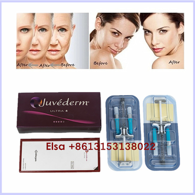المنتجات التجميلية Juvederm Ultra3 Ultra4 Voluma حقن جل حمض الهيالورونيك لحشو الجلد