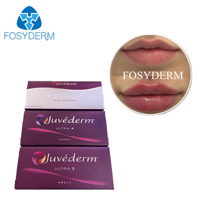 Juvederm الجلد ملء الحقن الحمض الهيالوروني المرتبط عبر HA Gel الوجه ملء المحقن المملئ مسبقًا