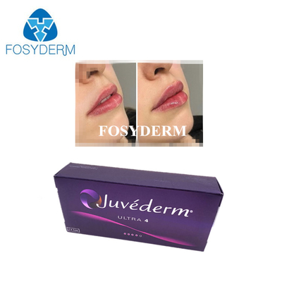 حمض الهيالورونيك الكوري المرتبط بالشحوم الجلدية Juvederm حقن حشو الشفاه