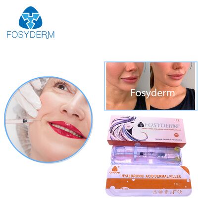 2ml Lip Filler Injection Hyaluronic Acid Dermal Filler Injectable for Lips Enlargement Gel