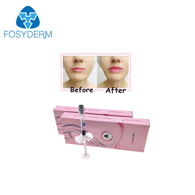 شفة أنف الذقن الامتلاء Crosslinked HA Hyaluronic Acid Injectable Filler 24mg / Ml