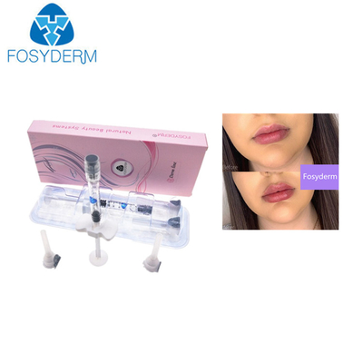 0.28 مم HA Dermal Fillers Hyaluronic Acid 1ml Lip Injection
