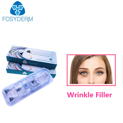1.1 مل حقن الوجه للتجاعيد HA Dermal Filler
