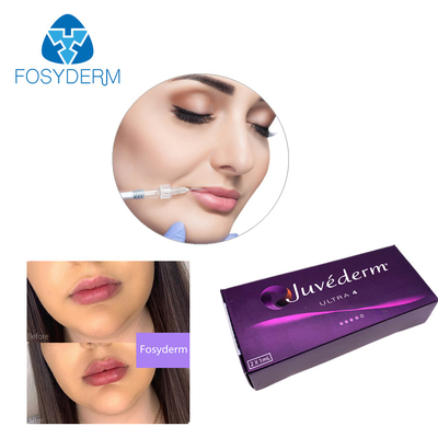 Ultra3 Ultra4 Voluma Hyaluronic Acid Dermal Filler Gel Juvederm Lip Filler 24mg / ml