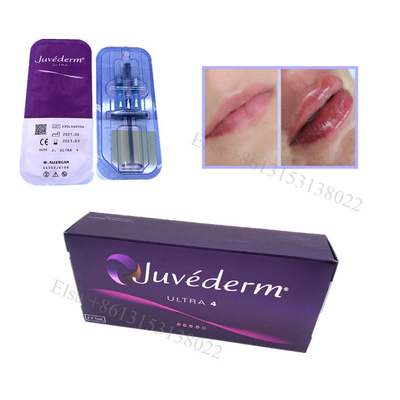 Juvederm Ultra4 حشو الجلد حشو الشفاه رفع الوجه